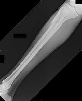Illustration 204 for OrthoCash: Trauma MCQs & Cases for a yearold woman