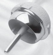 Illustration of around the femoral neck - Dr. Mohammed Hutaif