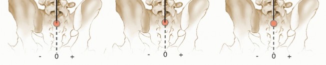 Illustration 9 for Adult Scoliosis: Uncover Causes & Find Lasting Back Pain Relief