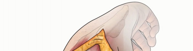 Illustration 40 for Surgical Approaches to Shoulder & Elbow: Pearls and Pitfalls