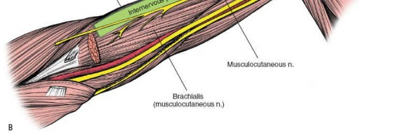 Illustration 8 for Mastering the Approach to the Distal Humerus: Safety & Skills