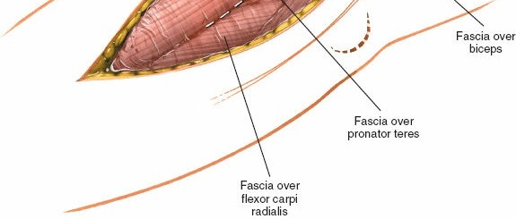 Illustration 58 for Mastering Elbow Approaches: Applied Surgical Anatomy for Precision