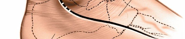 Illustration 188 for Optimized Approaches to the Dorsum of the Foot & Ankle