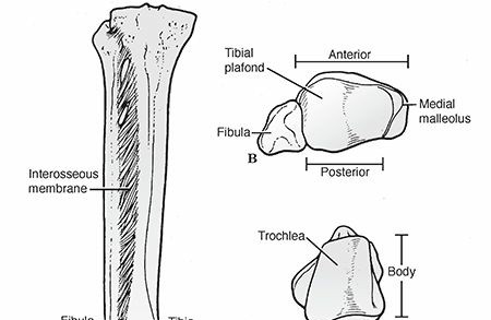 Illustration of injuries about the ankle - Dr. Mohammed Hutaif