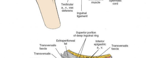 Illustration 58 for Ilioinguinal Approach: Master the Deep Inguinal Ring for Success