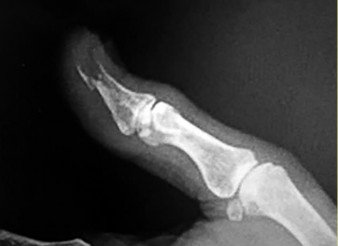 صورة طبية: دليل الأستاذ الدكتور محمد هطيف الشامل لأمراض وإصابات اليد والمعصم في صنعاء