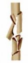 Illustration 10 for Optimal Nailing of the Tibia: Techniques for Challenging Fractures