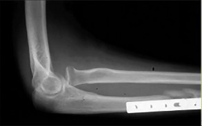 صورة طبية: دليل الأستاذ الدكتور محمد هطيف الشامل لأمراض وإصابات اليد والمعصم في صنعاء