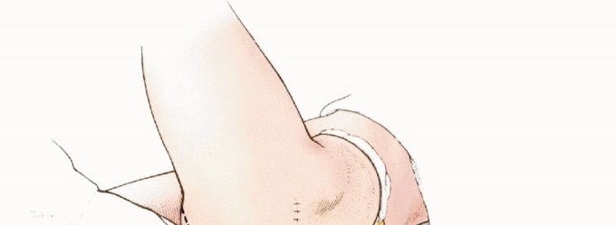 Illustration 15 for Anterior Flap Hemipelvectomy: Leveraging fig tech fig for Difficult Tumors