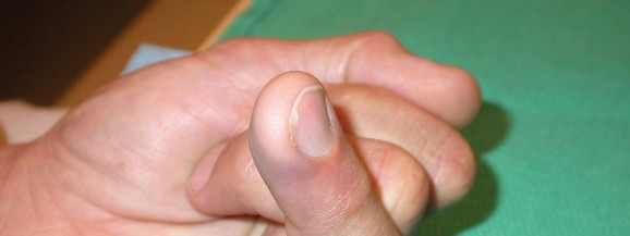 Illustration 9 for Orthopedic Hand Cases: A Patient's Journey, Is a Year Old a Factor?