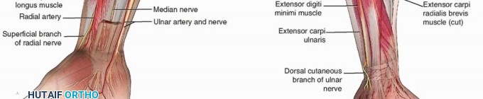 Illustration 3 for Optimal ORIF for Diaphyseal Forearm Fractures: Your Guide