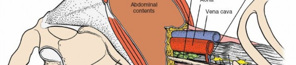 Illustration 164 for Approach to the Lumbar Spine: Mastering Techniques & Anatomy