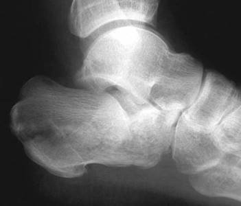 Illustration 4 for Ace Your FRCS: Key Questions in Trauma & Orthopaedics