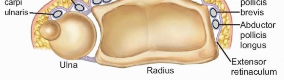 Illustration 2 for Distal Radius Fixation: Precision Through Lister's Tubercle