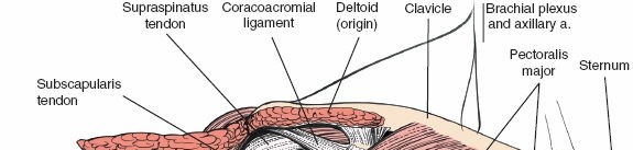 Illustration 13 for Enhance Anterior Shoulder Surgery: Crucial Joint Applied Surgical Anatomy
