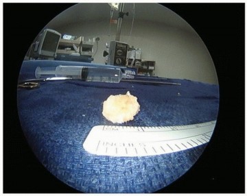 Illustration 10 for Hip Pain Relief: Arthroscopy for Nonstructural Pathology