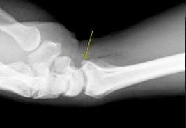 وصف طبي دقيق ومبسط للمريض