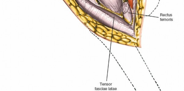 Illustration 49 for Unlocking Every Aspect of the Hip's Surgical Approaches