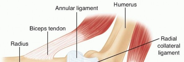 Unreconstructable Fractures? Explore Metallic Radial Head Arthroplasty