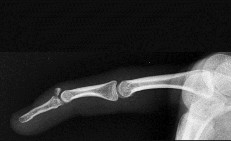 صورة طبية: دليل الأستاذ الدكتور محمد هطيف الشامل لأمراض وإصابات اليد والمعصم في صنعاء