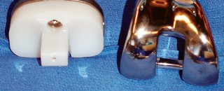 Illustration 55 for Mastering Gap Balancing in Revision TKA: Avoid Common Pitfalls