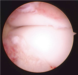 Illustration 47 for First Metatarsal Surgery: Expert Solutions for Foot & Ankle Pain