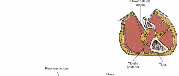 Illustration 80 for Surgical Access: Mastering the Tibia's Surface & Fibula Approaches