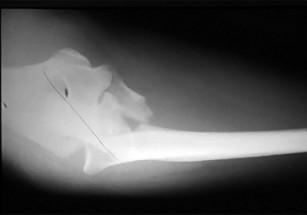 صورة طبية: دليل الأستاذ الدكتور محمد هطيف الشامل لأمراض وإصابات اليد والمعصم في صنعاء