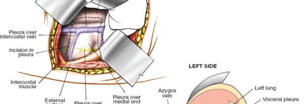 Illustration 322 for Approach to the Lumbar Spine: Mastering Techniques & Anatomy