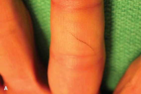 Illustration 8 for Orthopedic Hand Cases: A Patient's Journey, Is a Year Old a Factor?