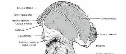 Illustration of pelvis fractures and dislocations - Dr. Mohammed Hutaif
