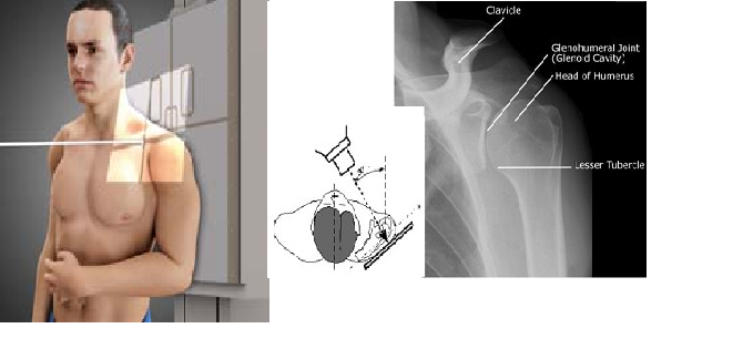 Pinpoint Shoulder Pain with Magnetic Resonance Imaging