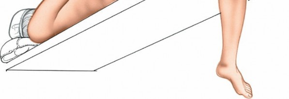 Illustration 135 for Mastering Knee Approaches: Spotlight on Superficial Medial Ligament