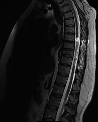 Illustration 5 for Cracking 11 Pediatric Cases: The Bar with Contralateral Guide