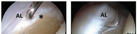 Illustration 18 for Beyond Knee Surg: Hip Arthroscopy for Sports Injuries