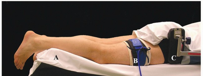 Illustration 3 for Posterior Talar Process: Endoscopic Solutions for Ankle Pain