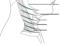 Illustration 2 for Exploring Every Approach to the Cervical: A Surgeon's Guide