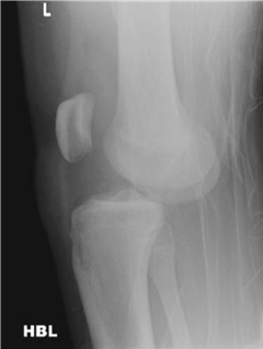 Illustration 7 for Ace Your FRCS: Key Questions in Trauma & Orthopaedics
