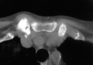 Illustration 22 for Solve Shoulder & Elbow Cases: When a Patient Presents to Clinic