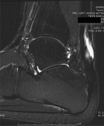 Illustration of knot of henry - Dr. Mohammed Hutaif