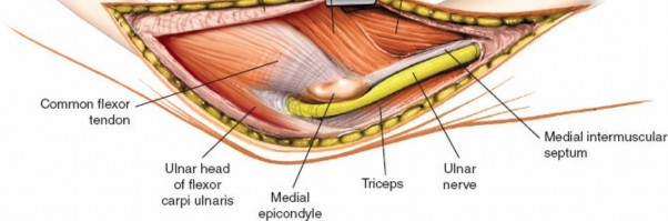 Illustration 45 for Mastering Elbow Approaches: Applied Surgical Anatomy for Precision