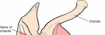 Illustration 139 for Essential Guide: Mastering Every Approach to the Shoulder