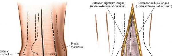 Illustration 4 for Optimized Approaches to the Dorsum of the Foot & Ankle