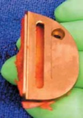 Illustration 13 for Knee Arthroplasty Unicondylar: Discover if Partial Knee Replacement is Right