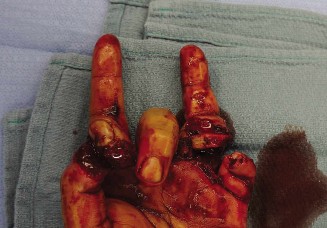 Illustration of rate of nerve - Dr. Mohammed Hutaif