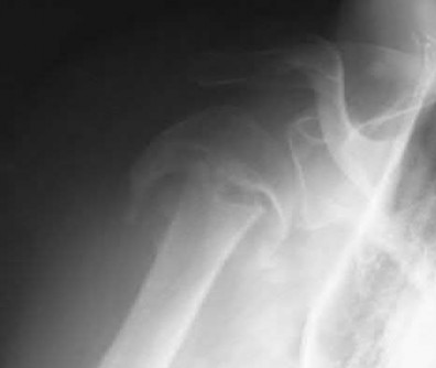 Illustration 84 for OrthoCash: Trauma MCQs & Cases for a yearold woman