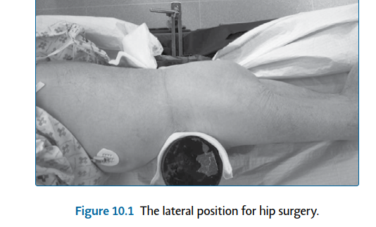Illustration 4 for Mastering Short External Rotators for Optimal Hip Surgery Results