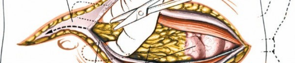 Illustration 66 for Approach to the Lumbar Spine: Mastering Techniques & Anatomy