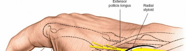 Illustration of approach to the scaphoid - Dr. Mohammed Hutaif