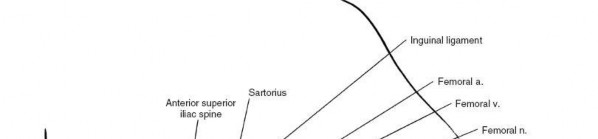 Illustration 64 for Unlocking Every Aspect of the Hip's Surgical Approaches